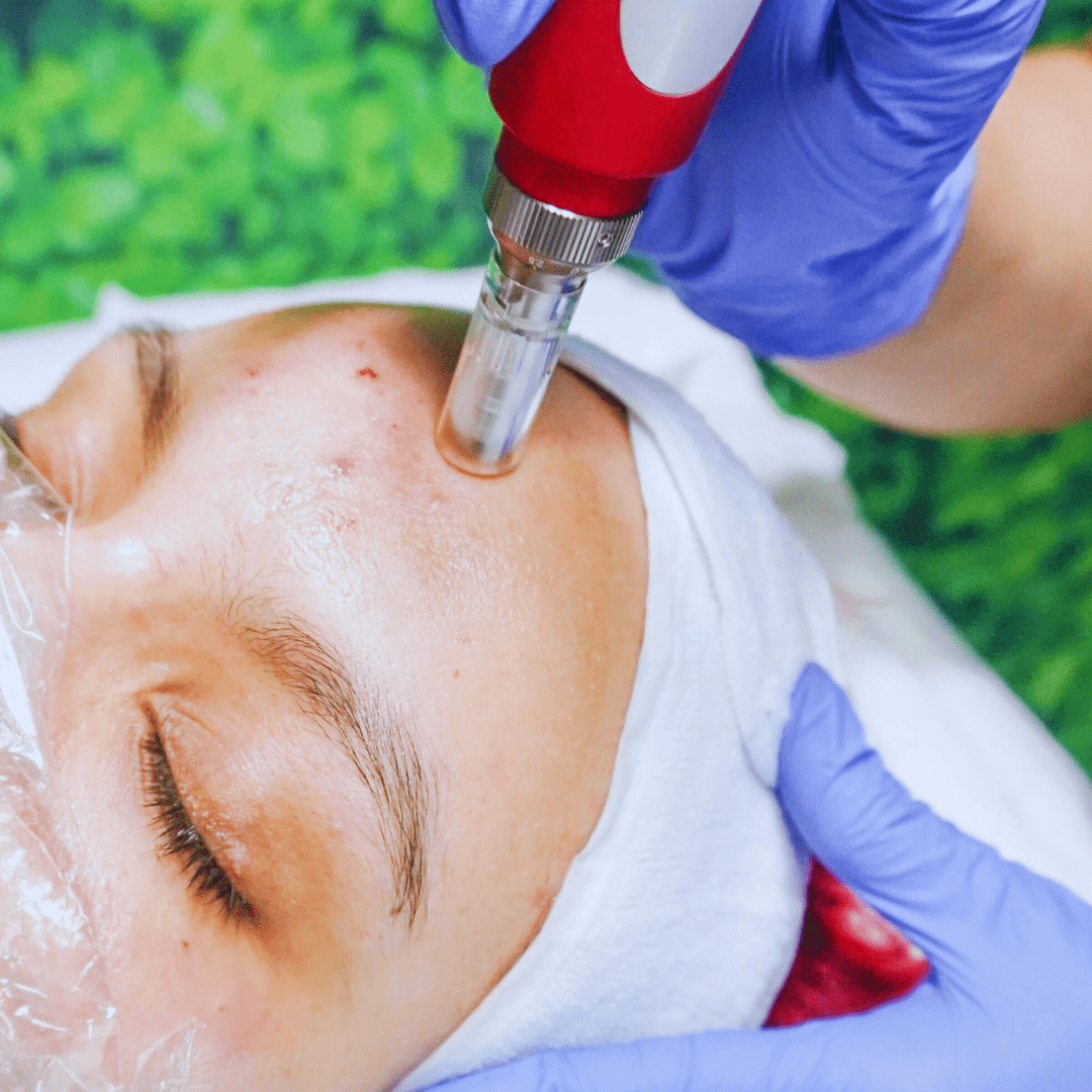 Dromond Dermabrasion & Advanced Body Facials 3
