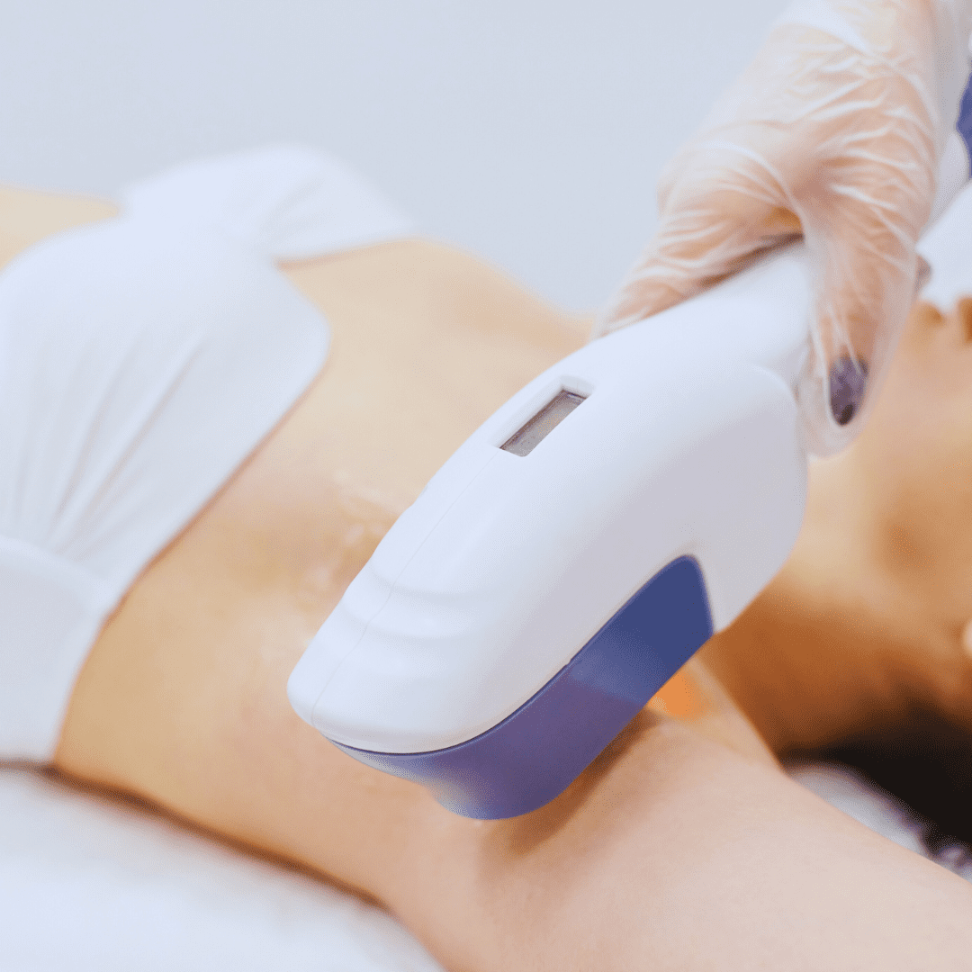 Face & Body Laser Treatments 5