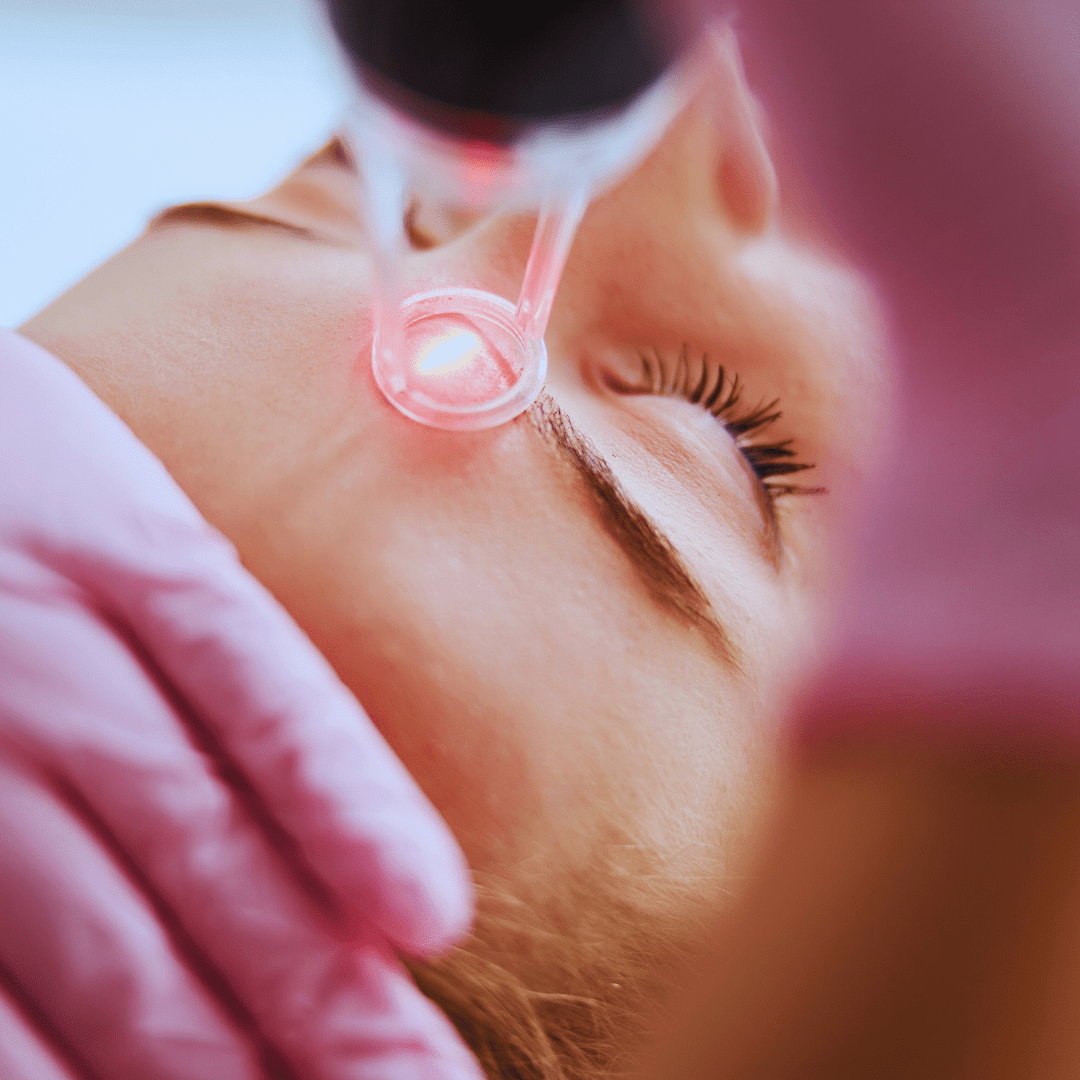 Face & Body Laser Treatments 6