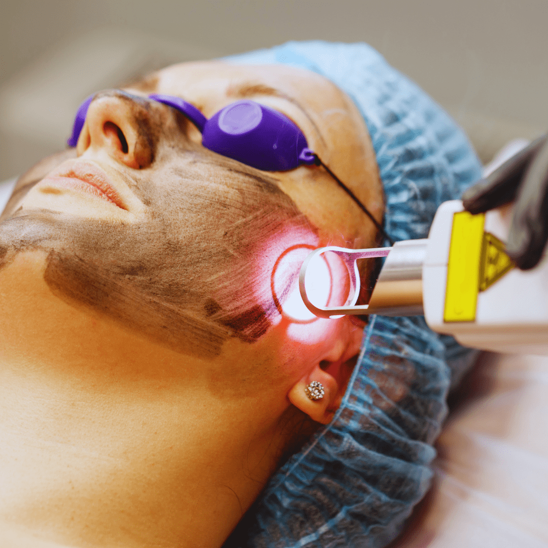 Face & Body Laser Treatments 7