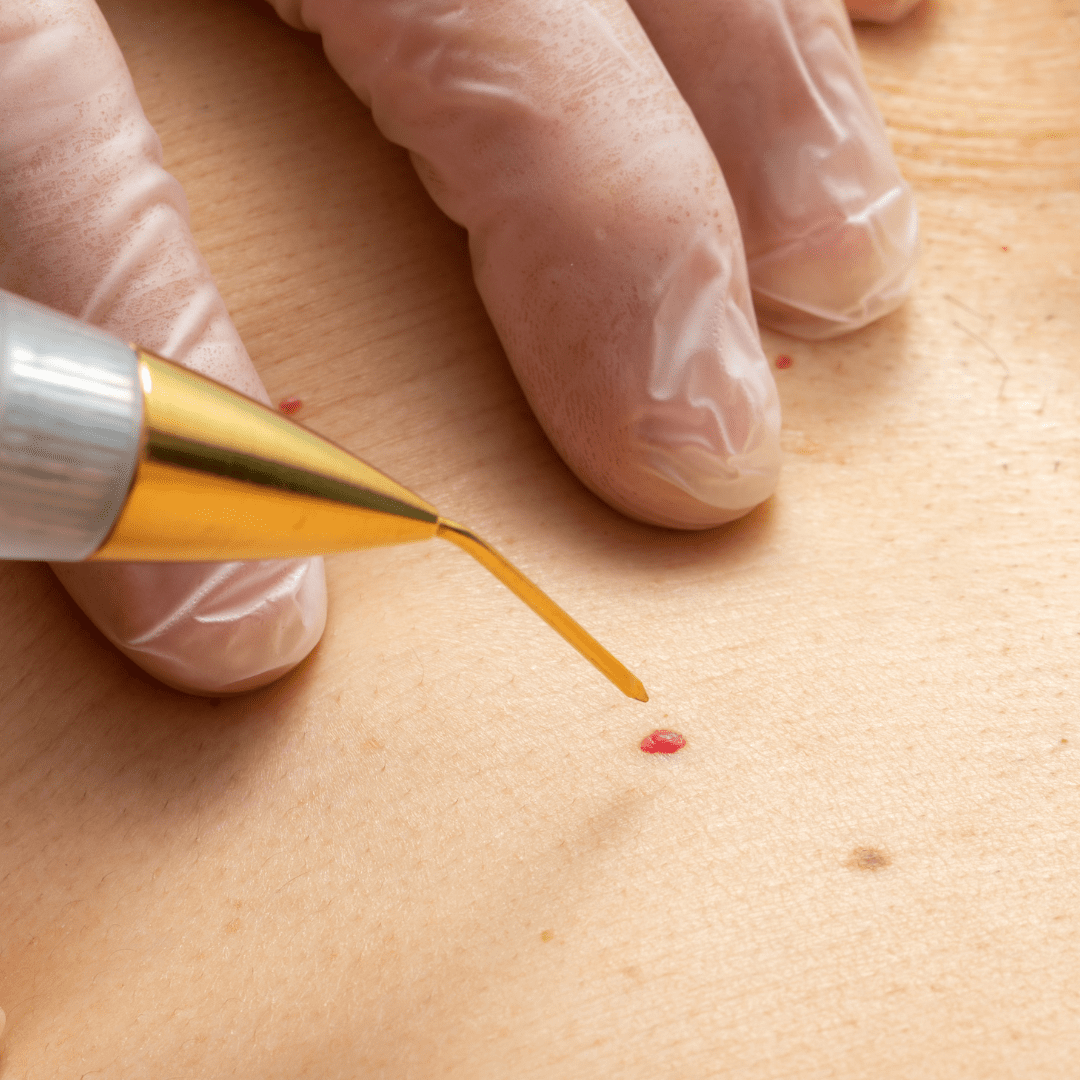 Advanced Aesthetic Procedures 19