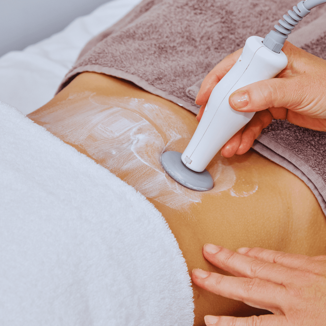 Face & Body Laser Treatments 11