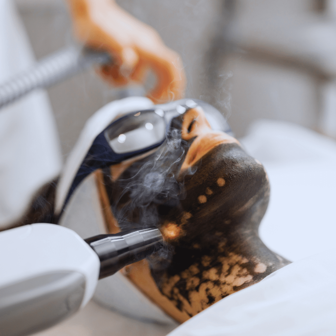 Face & Body Laser Treatments 21