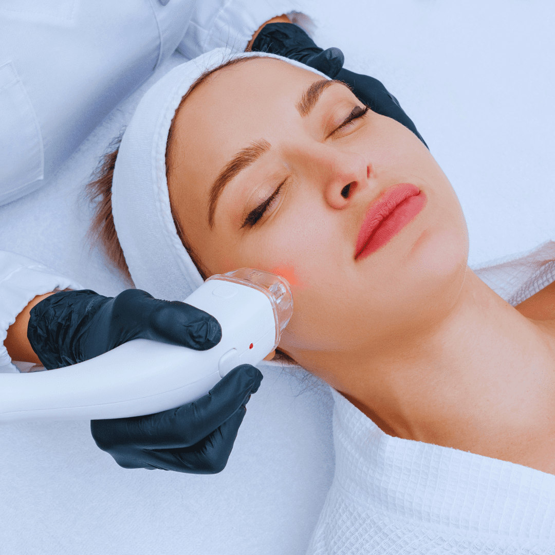 Face & Body Laser Treatments 22