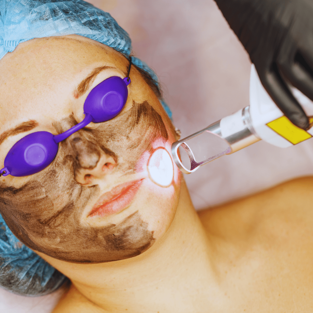 Face & Body Laser Treatments 24