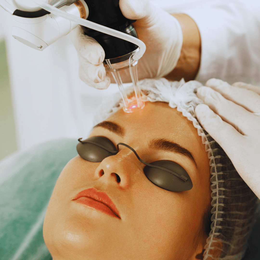 Face & Body Laser Treatments 25