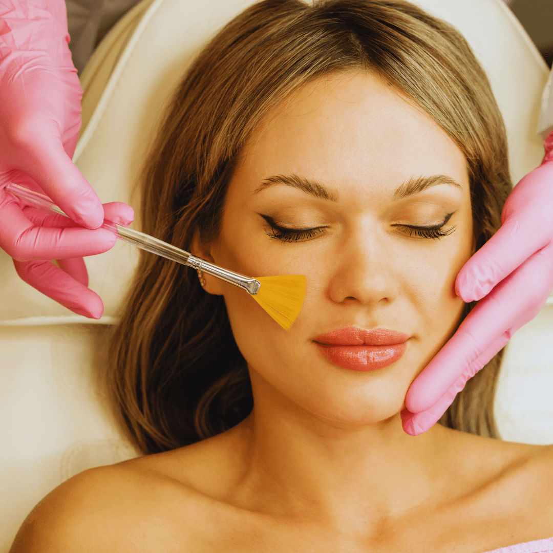 Chemical Peel 6